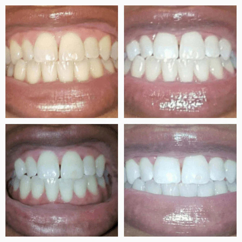 Teeth Whitening Gold Serum Pen