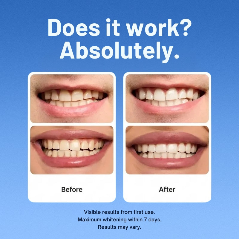 Purple Whitening Strips