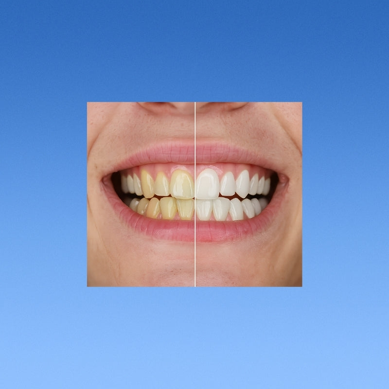 Teeth Whitening Gold Serum Pen