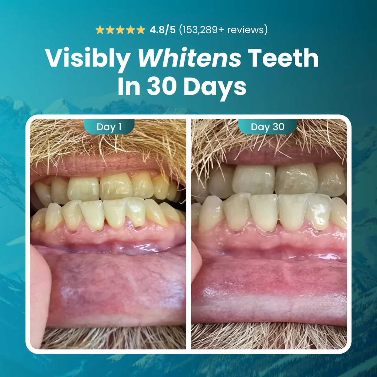 Remineralizing Chewing Gum