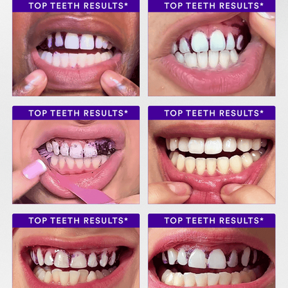 V34 Whitening Strips