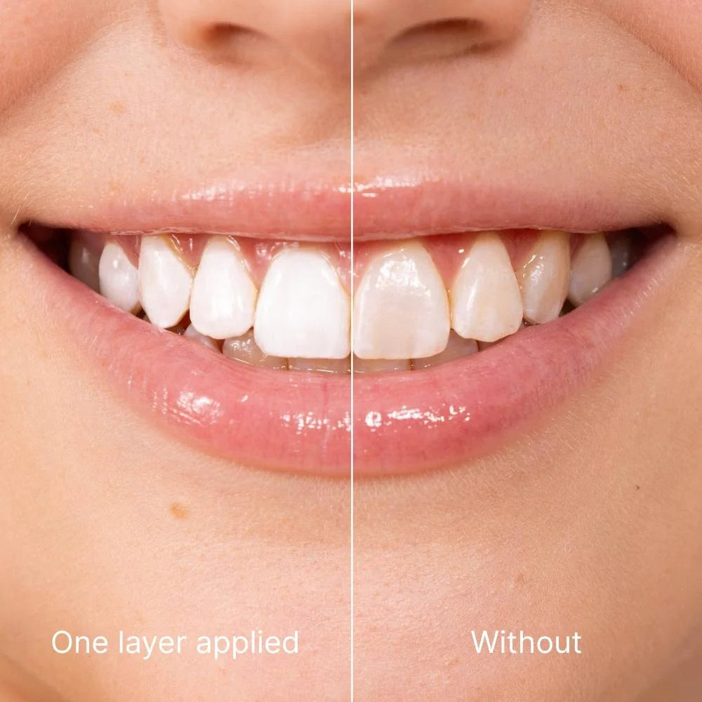 Tooth Polish
