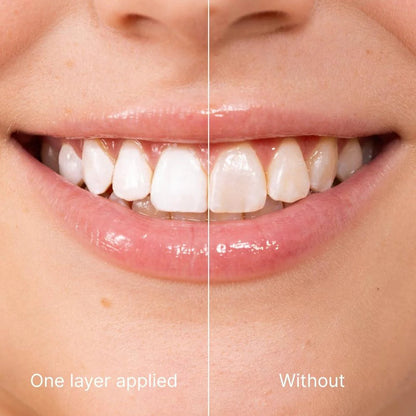Tooth Polish