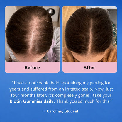 Biotin Gummies for Hair Growth