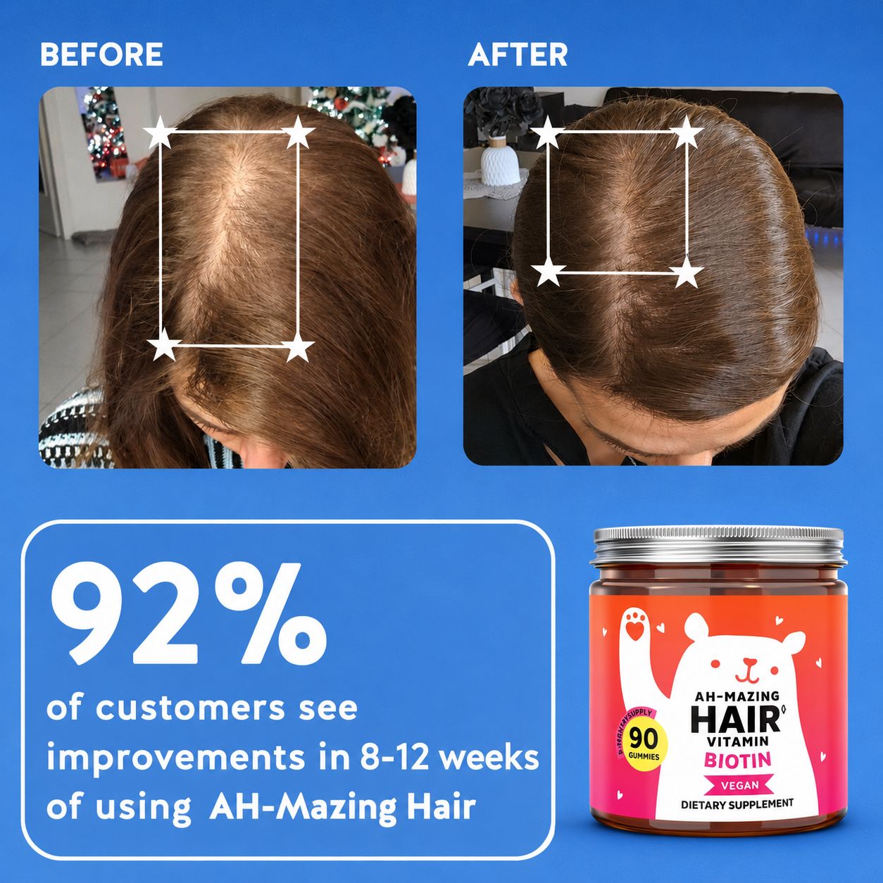 Biotin Gummies for Hair Growth